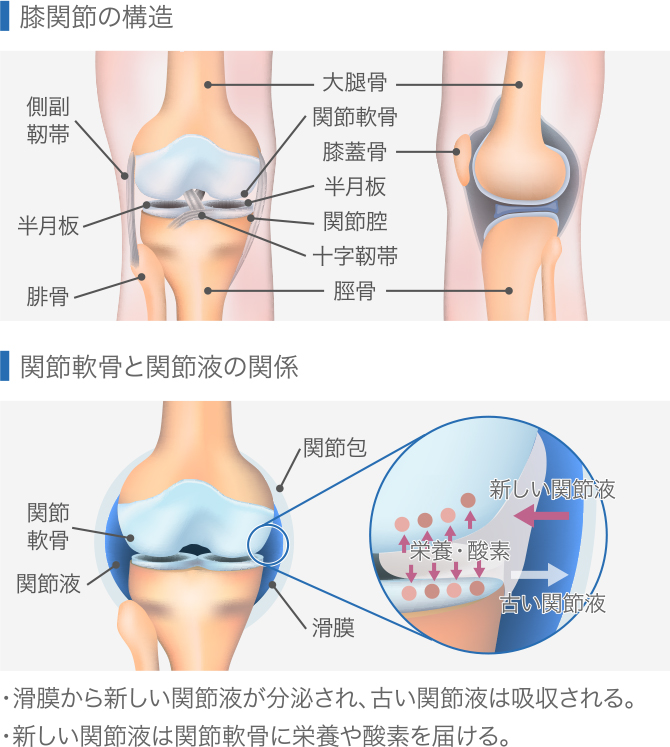 変形性膝関節症 症状と治療法について 福岡ひざ関節症クリニック