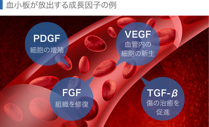 血小板が放出する成長因子の例